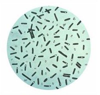 什么是肉毒梭菌?肉毒梭菌的症状及治疗方法