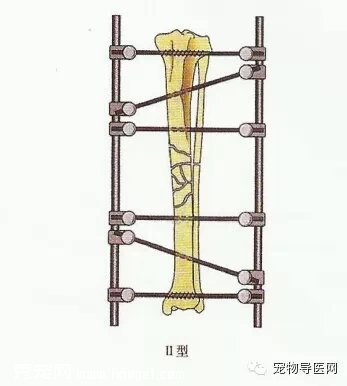 ���������á�����èè���۹̶�������ʧ��ԭ�����